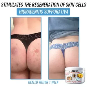 QIAWI Bee Venom Multi-Symptom Treatment Cream