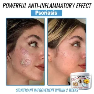 QIAWI Bee Venom Multi-Symptom Treatment Cream