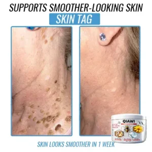 QIAWI Bee Venom Multi-Symptom Treatment Cream