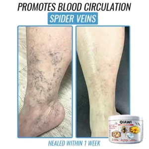 QIAWI Bee Venom Multi-Symptom Treatment Cream