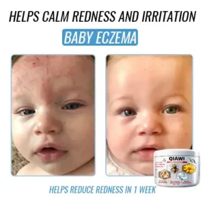 QIAWI Bee Venom Multi-Symptom Treatment Cream