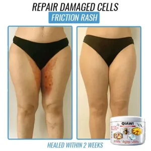 QIAWI Bee Venom Multi-Symptom Treatment Cream