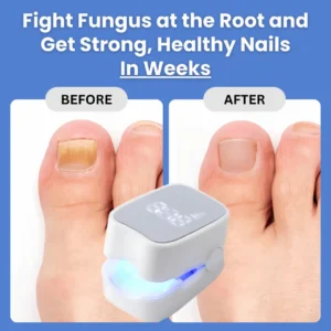 QIAWI™ - Nail Fungus Laser Device