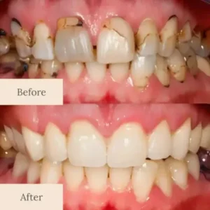 QIAWI® Teeth Armor Drops