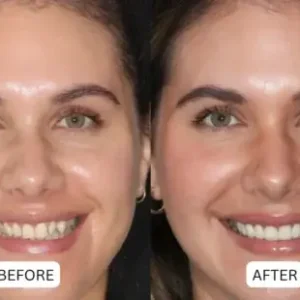 QIAWI® Teeth Armor Drops