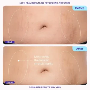 QIAWI®  Tighten & Smooth Belly Cream