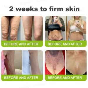 [🔥Last Day 70% OFF] QIAWI™ Botox & Retinol Shot - Eraser for Deep Wrinkles, Sagging Jowls & Puffy Eyes