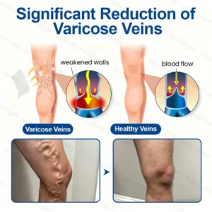 🧙QIAWI™  VeinTarget Microneedle Patch⚡Instant Relief, Long-Term Results