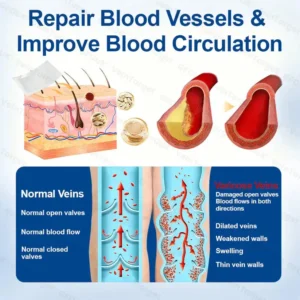 🧙QIAWI™  VeinTarget Microneedle Patch⚡Instant Relief, Long-Term Results