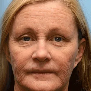 🔥Final 3 Hours: 70%OFF🔥 QIAWI™ Botulinum & Vita-A Complex Shot Wrinkle-Lift Tightening cream✨