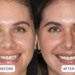 🔥Last Day Promotion 49% Off🦷 QIAWI® Teeth Armor Drops✨