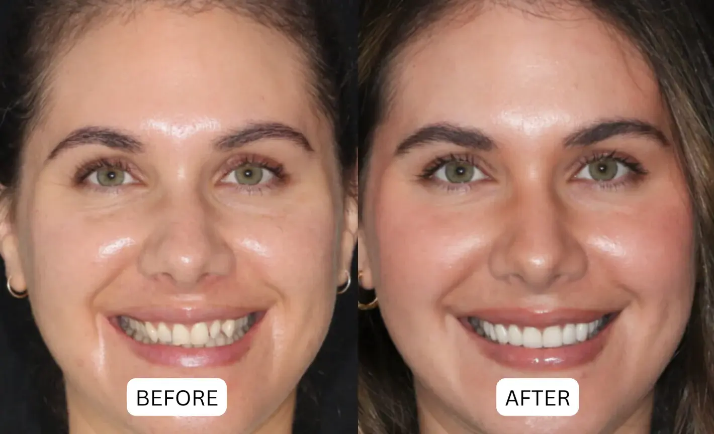 🔥Last Day Promotion 49% Off🦷 QIAWI® Teeth Armor Drops✨