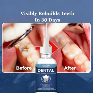 🔥Last Day Promotion 49% Off🦷 QIAWI® Teeth Armor Drops✨