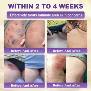 Made and Shipped from USA ✨QIAWI® Biotin 10-in-1 Skin Restoration Cream 🍀