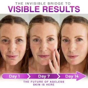 QIAWI® 3-in-1 Microneedle Anti-Aging Patch