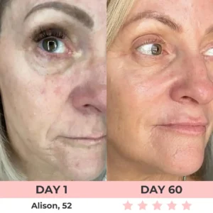 QIAWI 7-in-1 LED Facial Sculptor