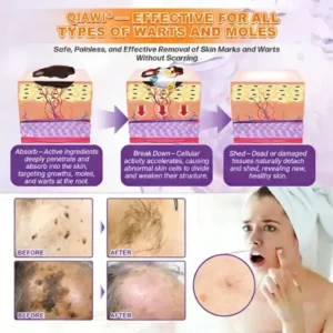 QIAWI® Proprietary Biotin Blend Skin Restoration Cream