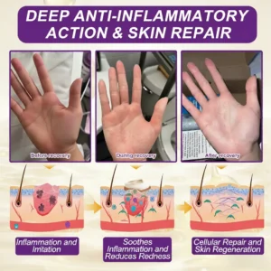 𝐎𝐟𝐟𝐢𝐜𝐢𝐚𝐥 𝐒𝐭𝐨𝐫𝐞 |  🏅 Made and Shipped from USA ✨QIAWI® Biotin 10-in-1 Skin Restoration Cream 🍀