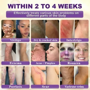 🔥LAST DAY 70% OFF -Made and Shipped from USA ✨QIAWI® Biotin 10-in-1 Skin Restoration Cream 🍀