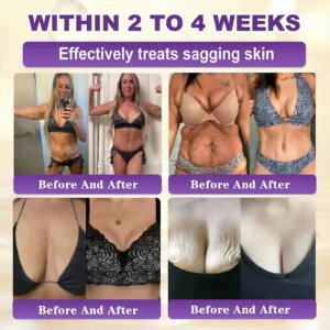 🔥LAST DAY 70% OFF -Made and Shipped from USA ✨QIAWI® Biotin 10-in-1 Skin Restoration Cream 🍀