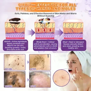 🔥LAST DAY 70% OFF -Made and Shipped from USA ✨QIAWI® Biotin 10-in-1 Skin Restoration Cream 🍀