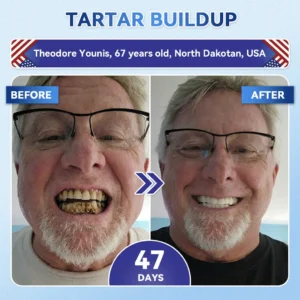 QIAWI® 🦷 Tideglusib Fast‑Dissolving Tooth & Gum Repair Oral Strips 😁 (Supports tooth repair and helps relieve gum discomfort and other common oral concerns)