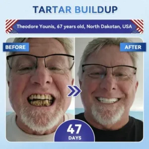 QIAWI® Tideglusib Fast‑Dissolving Tooth & Gum Repair Oral Strips