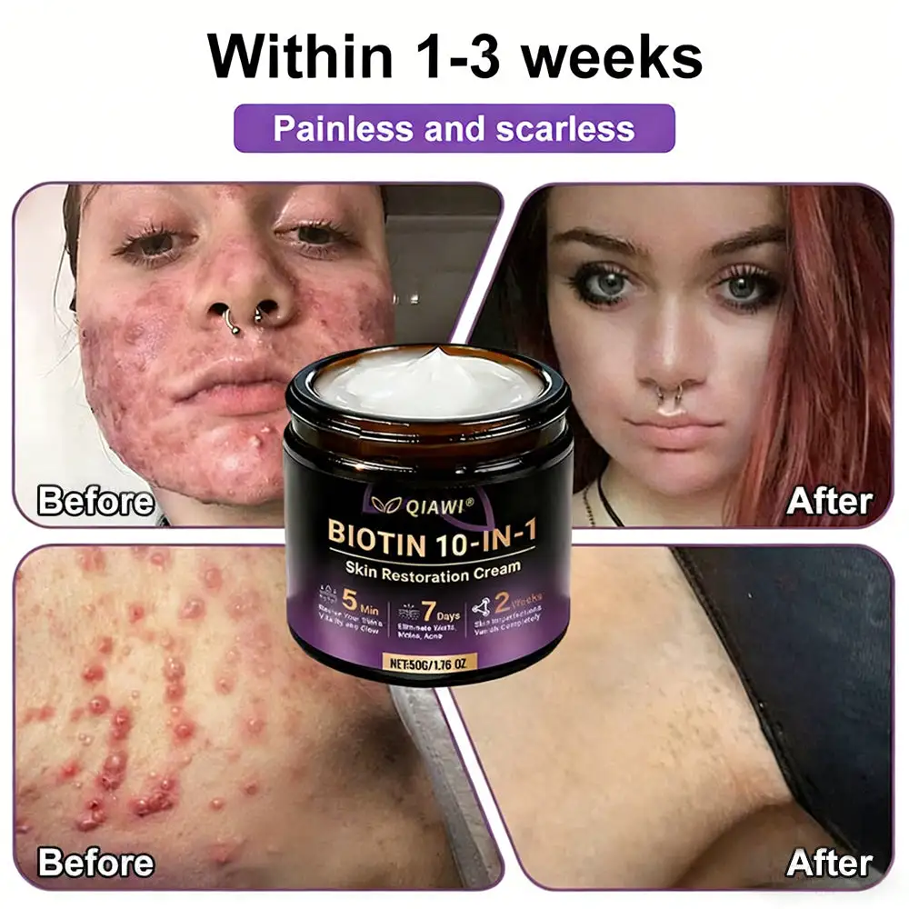 Made and Shipped from USA ✨QIAWI® Biotin 10-in-1 Skin Restoration Crea
– Clenohome