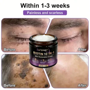 Made and Shipped from USA ✨QIAWI® Biotin 10-in-1 Skin Restoration Crea
– Clenohome