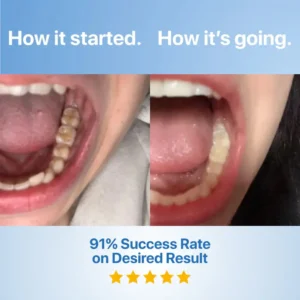 QIAWI Fluoride-Free Hydroxyapatite Tooth Armor Essence & Enamel Repair