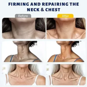 QIAWI™ 5-Roller Neck Firming Cream – Collagen & Hyaluronic Acid for Smoother, Tighter-Looking Neck Skin