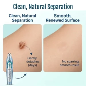 QIAWI® SpotlessPro Advanced Skin Care Pen