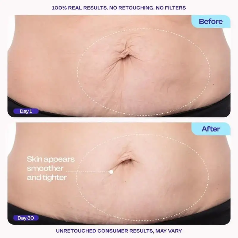💕QIAWI TIGHTEN & SMOOTH BELLY FIRMING CREAM
– Softgarnish