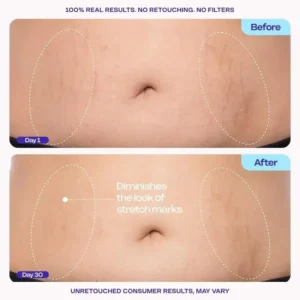 💕QIAWI TIGHTEN & SMOOTH BELLY FIRMING CREAM
– Softgarnish