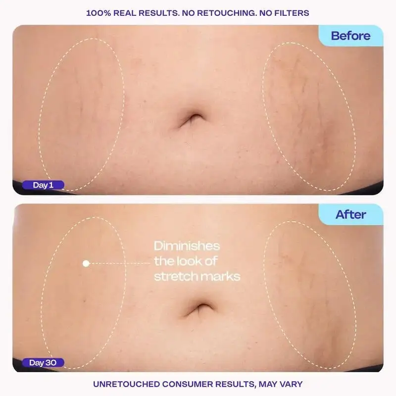 💕QIAWI TIGHTEN & SMOOTH BELLY FIRMING CREAM
– Softgarnish