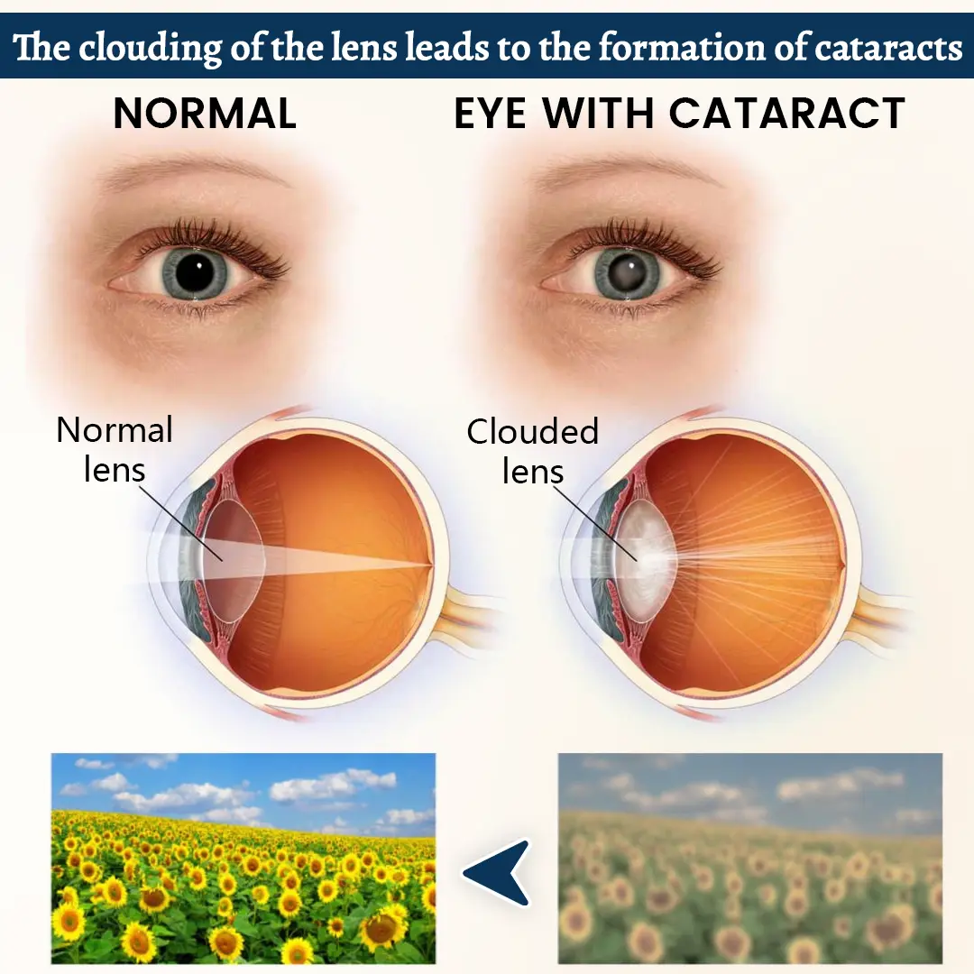 QIAWI® Potent Vision Support Eye Patch👁️✨